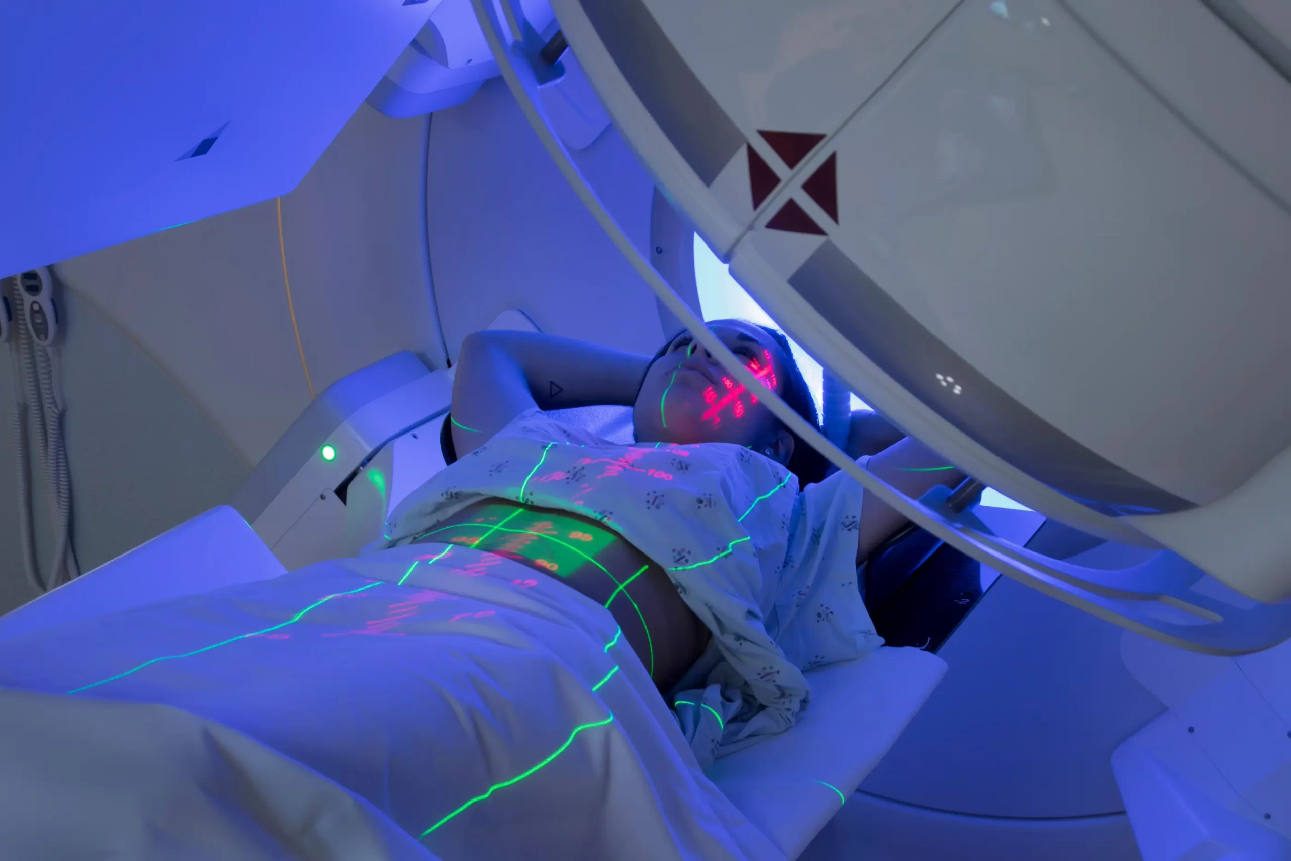 Radiocirugía estereotáctica SRS/SBRT