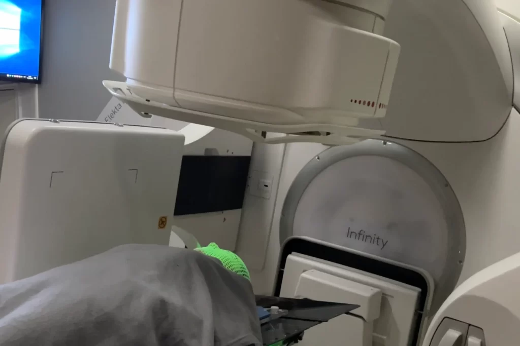 Tecnología Elekta Infinity para radiocirugía estereotáctica SRS/SBRT en ROS Clínica Oncológica.