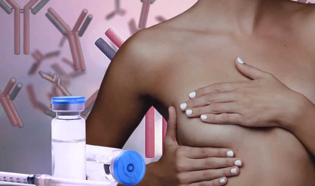 Mujer con cáncer de mama sometida a tratamiento con anticuerpos conjugados, como parte de una terapia combinada de inmunoterapia y radioterapia