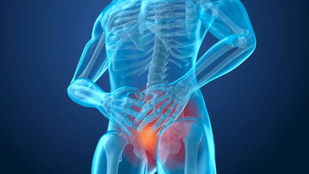 magen médica de cuerpo humano resaltando la zona prostática, donde se aplica la radioterapia para tratar el cáncer de próstata de forma localizada.