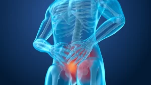 magen médica de cuerpo humano resaltando la zona prostática, donde se aplica la radioterapia para tratar el cáncer de próstata de forma localizada.