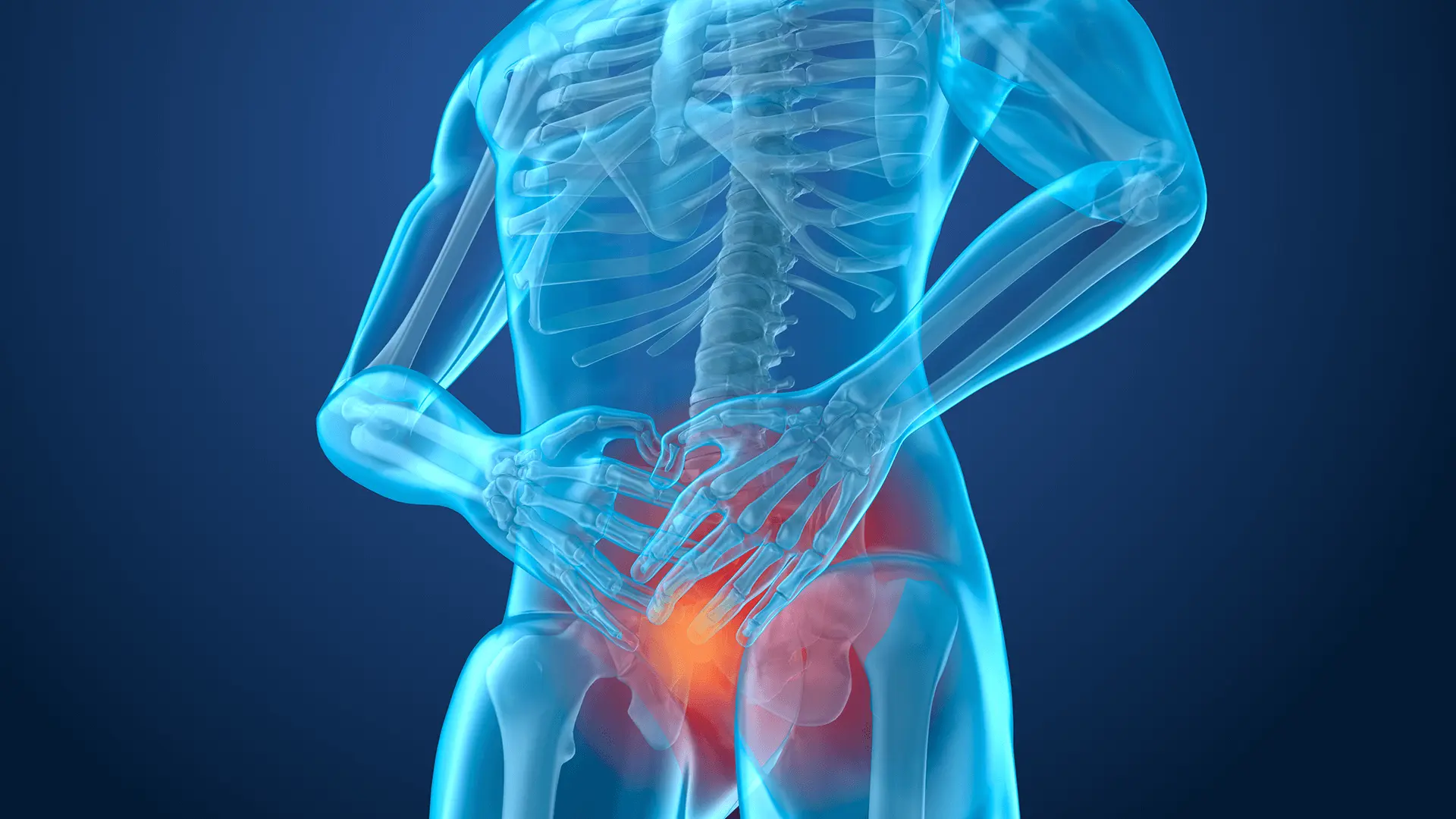 magen médica de cuerpo humano resaltando la zona prostática, donde se aplica la radioterapia para tratar el cáncer de próstata de forma localizada.