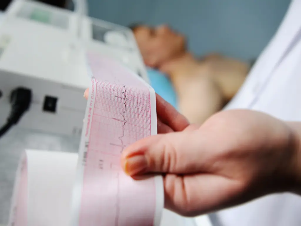 Electrocardiograma utilizado para monitorear la función cardíaca en pacientes oncológicos